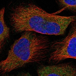N-Acetyl-D-Glucosamine Kinase/NAGK Antibody, Novus Biologicals 0.1mL; Unlabeled:Antibodies,